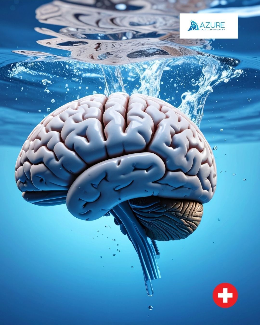 AzureCell Therapies, développe des traitements cellulaires pour aider les patients atteints de la maladie de Parkinson.
Nouveau post sur le blog📝
Lien dans la bio👆
Le travail de la start-up, spin Off de l’Université de Genève, consiste à développer des thérapies cellulaires régénératives contre la maladie de Parkinson. Cette maladie neurodégénérative touche plus de 10 millions de personnes dans le monde et ce chiffre augmente rapidement. Les statistiques indiquent qu’une nouvelle personne serait diagnostiquée avec cette maladie toutes les 9 minutes.
Les traitements actuels soulagent les symptômes, mais ne stoppent pas la progression de la maladie. Les thérapies cellulaires régénératives représentent une piste prometteuse pour traiter la cause profonde de la maladie : la perte des neurones producteurs de dopamine.
Une avancée que cette future Biotech veut accélérer, dès le second semestre 2025.
#medtech #biotech #swissstartup #parkinsondisease #cell #venturekick #azurecelltherapies #geneve #switzerland
#standwithukraine 💙💛