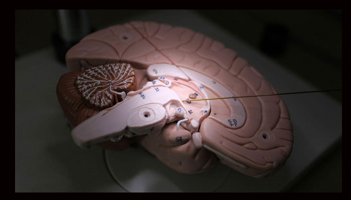 Aleva neurotherapics